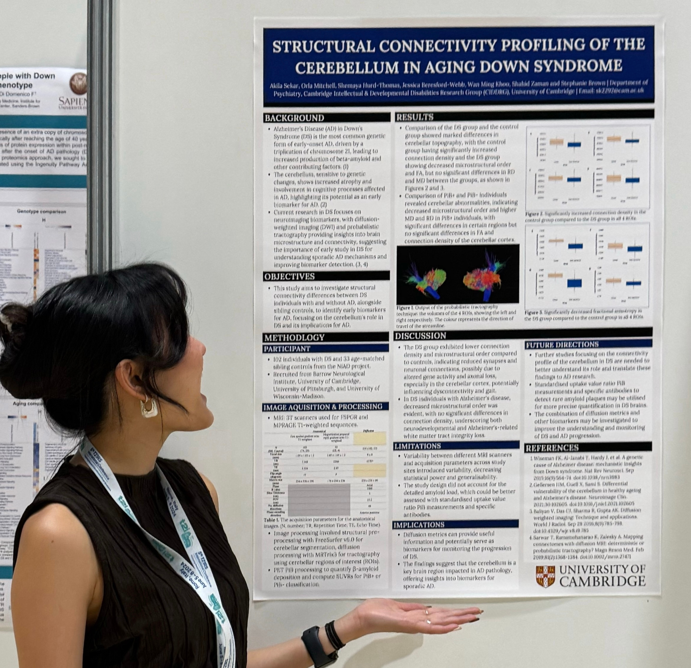 Sarah stands in front of her research poster entitled Structural connectivity profiling of the cerebellum in aging Down syndrome